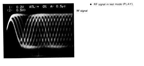 normal_eye_diagram.jpg